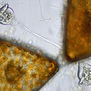 Ciliate on diatoms